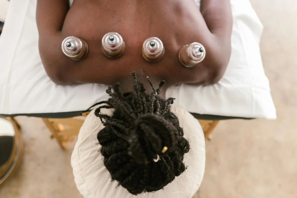 Cupping therapy massage in Edmonton for muscle pain and tension relief